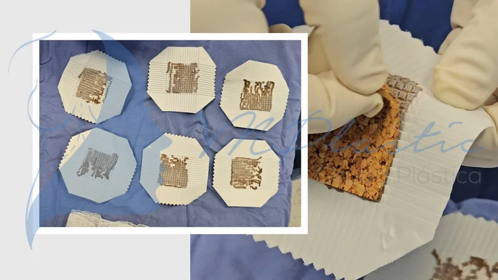 Microinjertos Meek: Innovación en el Tratamiento de Grandes Quemaduras y Pérdida de Tejido 6 Retiro_soporte_microinjertos_meek